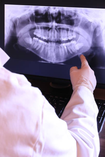 Best Dental Abscess Treatment in Storm Lake, IA